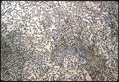 Spheroidized tool steel at 100X etched