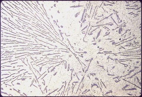 Aluminum - 12% silicon alloy at 200X